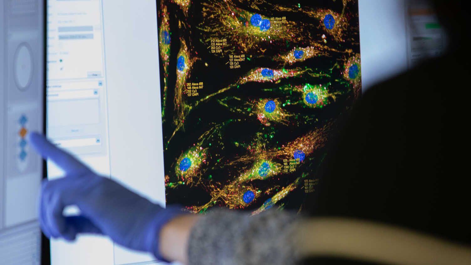 A person is pointing at a computer screen while wearing a blue protective glove.  They appear to have dark brown or black hair, though only the back/side of their head is visible. They are wearing a grey knitted or textured long-sleeve top.  The screen shows brightly coloured microscope or cell-imaging visuals, with blue, green, red, and yellow markings.
