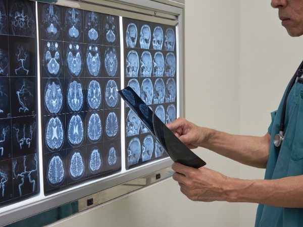 A medical professional examines brain scan images displayed on a lightbox while holding an X-ray film, in a clinical setting.