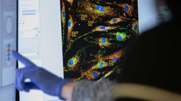 Sheffield scientists awarded global prize to pursue AI-driven treatments for ALS